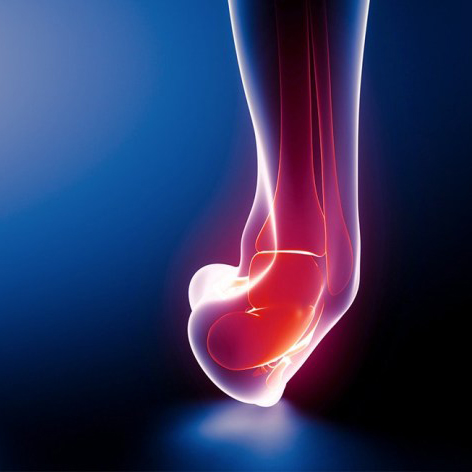 Sprain and Strain Treatment St Albert