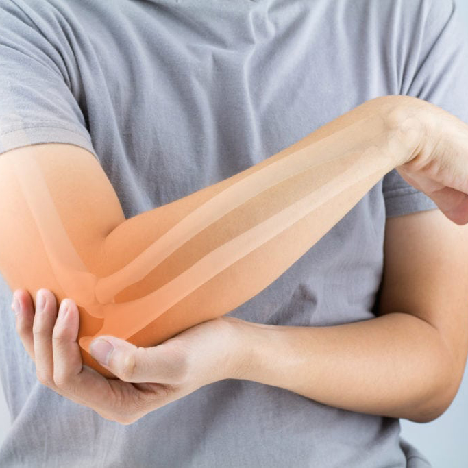 Tendonitis Treatment St Albert
